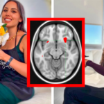 What Losing 20 Lbs. Does To The Brain!